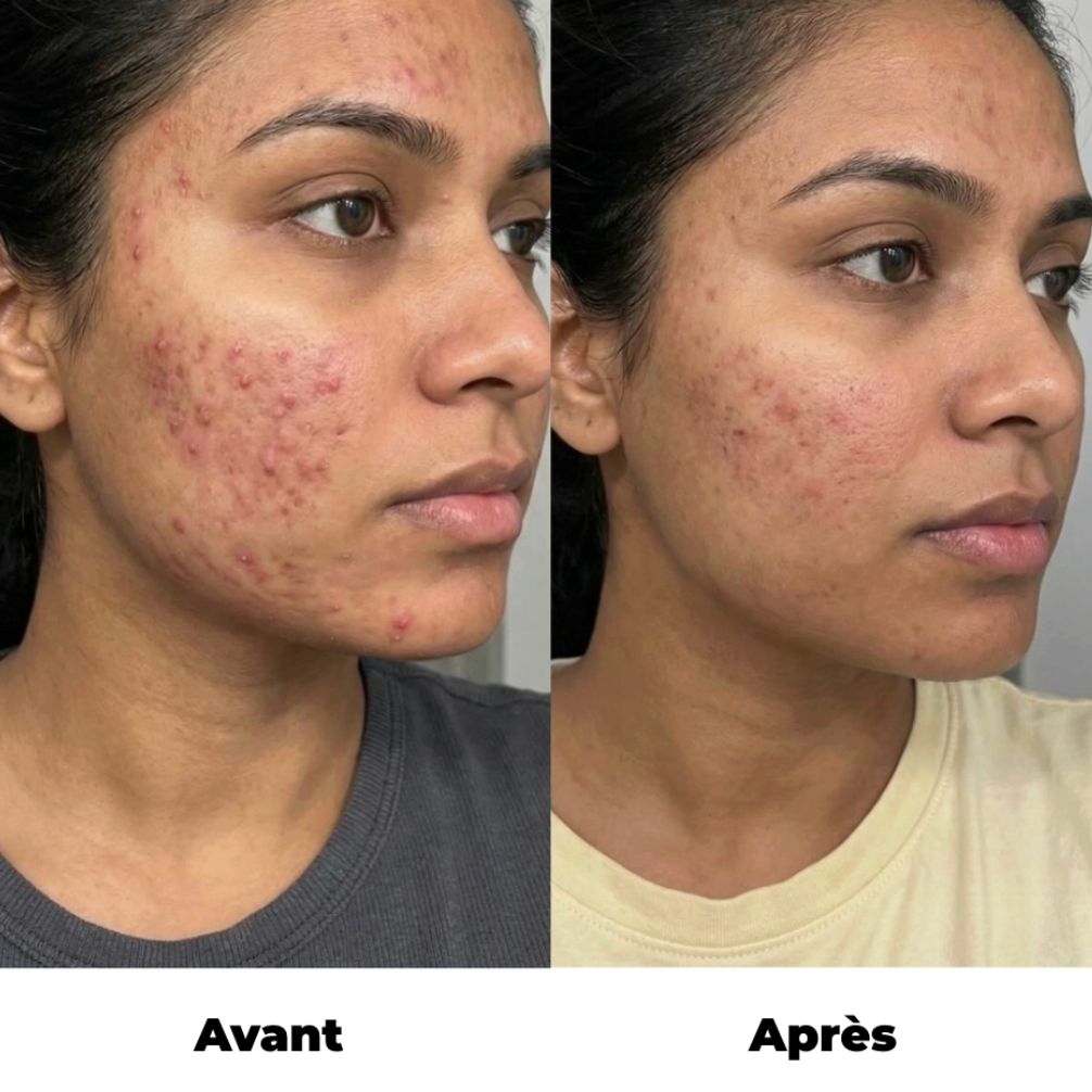 Taie d'oreiller Séléné